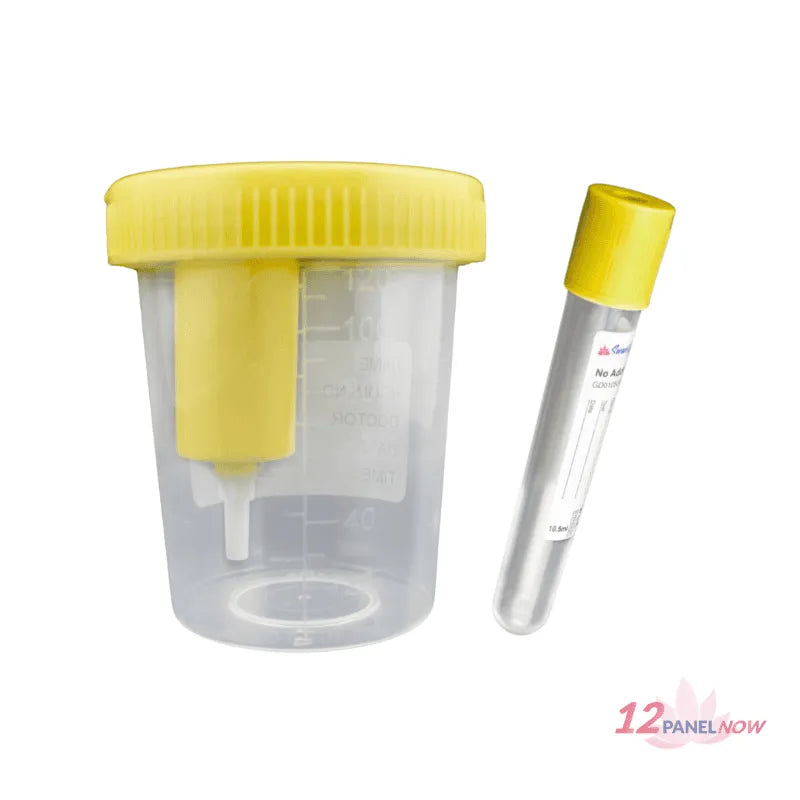 Vacuum Tube | Urine Specimen Collection, Low price $0.12, No Free Delivery on this Item!
